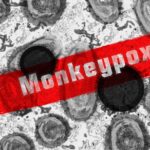 Monkeypox Vaccine In High Demand As The Virus Spreads